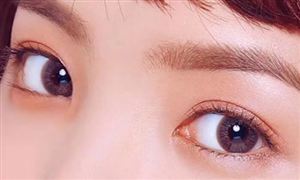 美瞳隱形眼鏡市場需求 美瞳隱形眼鏡行業(yè)趨勢分析