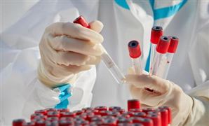 需求退潮，核酸檢測(cè)企業(yè)走向何處去?在 2023年核酸檢測(cè)行業(yè)市場(chǎng)發(fā)展現(xiàn)狀